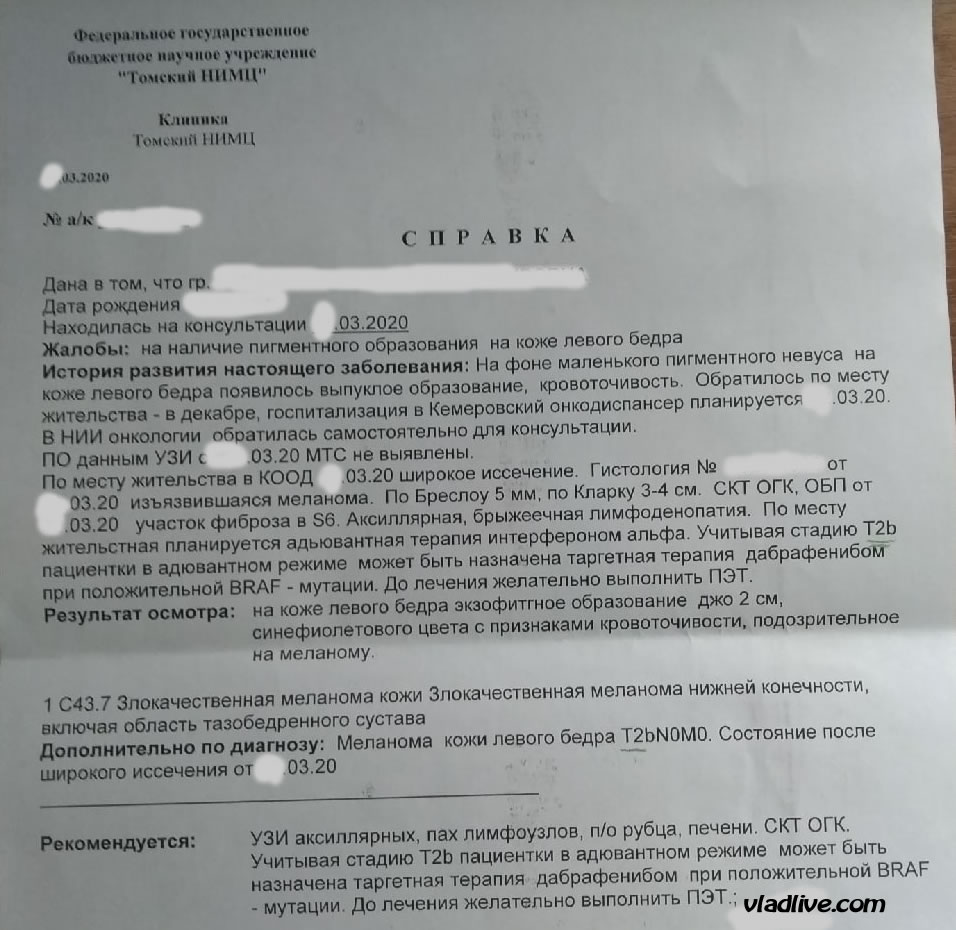 Меланома. Лечение в Томске
