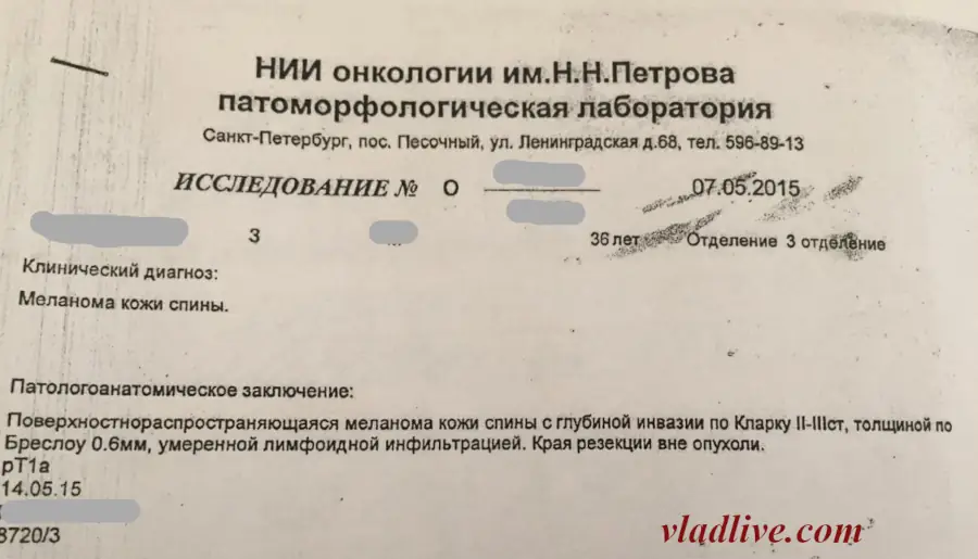 Меланома 0.6 мм по Бреслоу, гистология