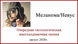 Про меланому и гистологию