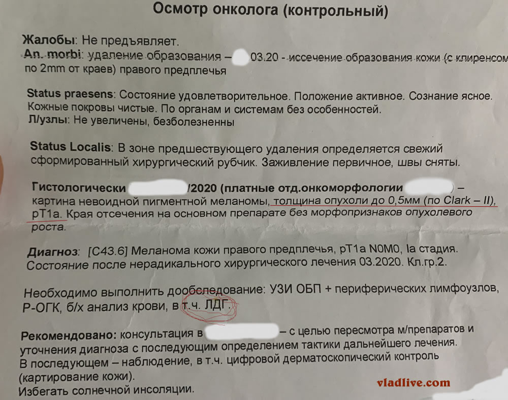 Меланома