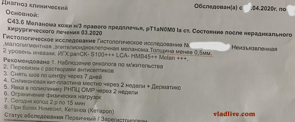 Меланома. Гистология
