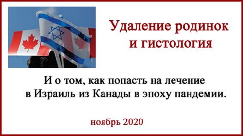 Удаление родинок в Израиле