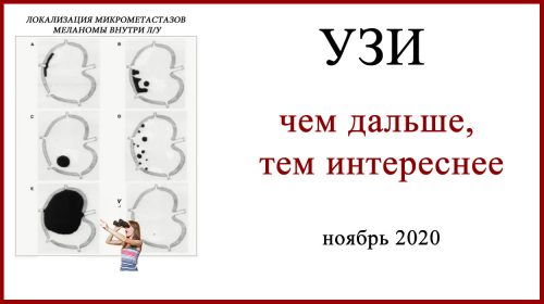 Диагностика меланомы УЗИ