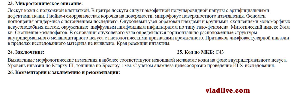 Меланома гистология