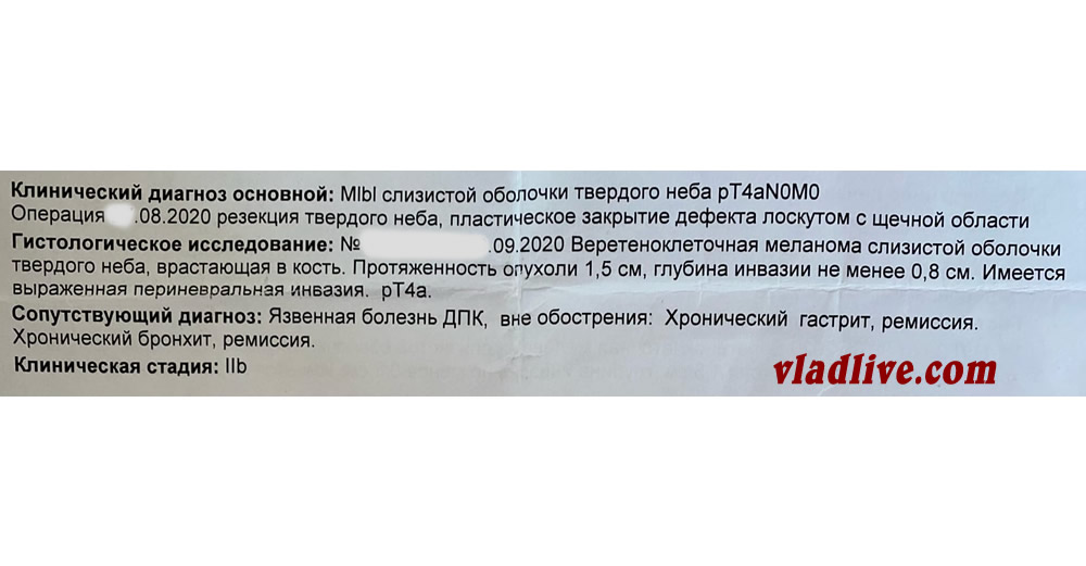 Меланома слизистой твердого неба. Гистология