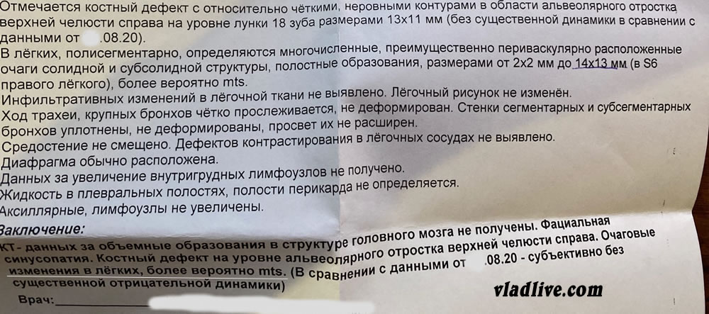 Меланома слизистых. КТ