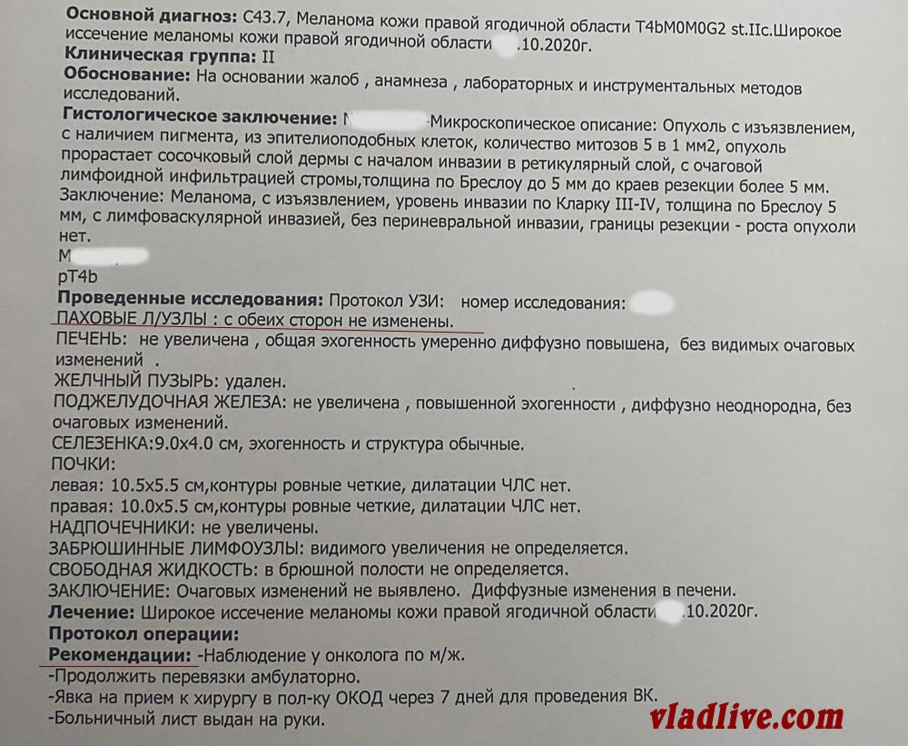Диагностика меланомы УЗИ