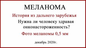 Фото меланомы 0.5 мм. История из Америки
