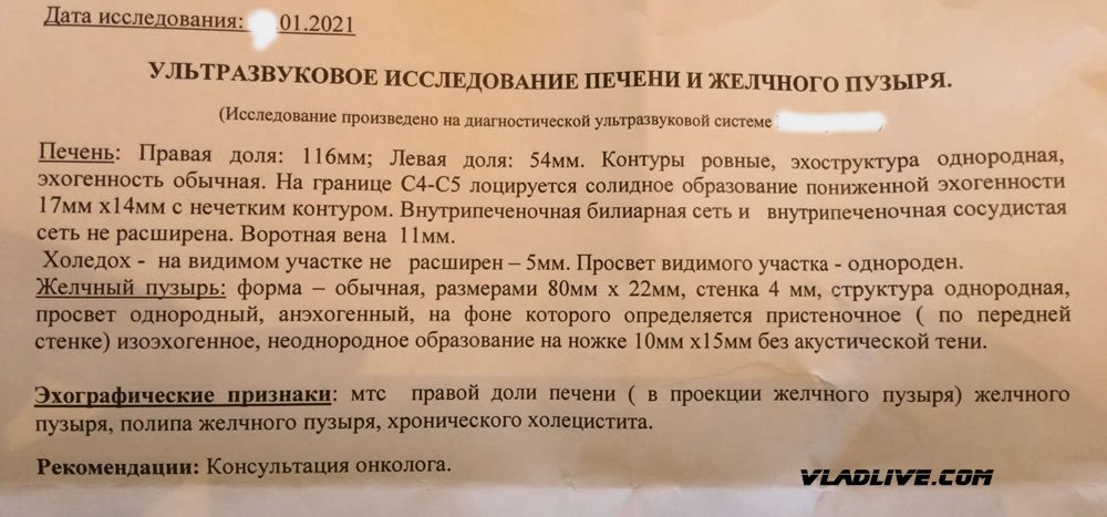 Меланома УЗИ метастаз