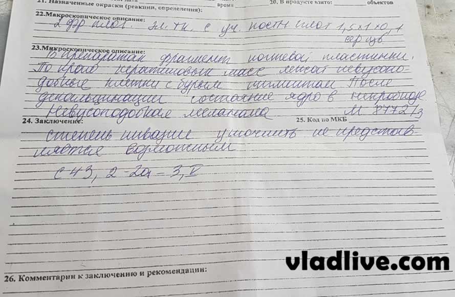 Подногтевая меланома гистологическое исследование