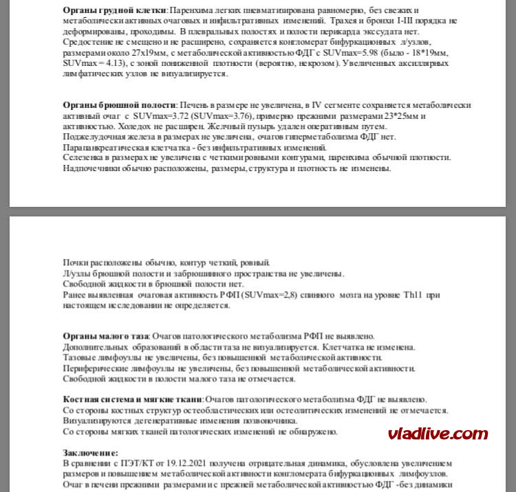 ПЭТ КТ. Увеличенные бифуркационные лимфоузлы