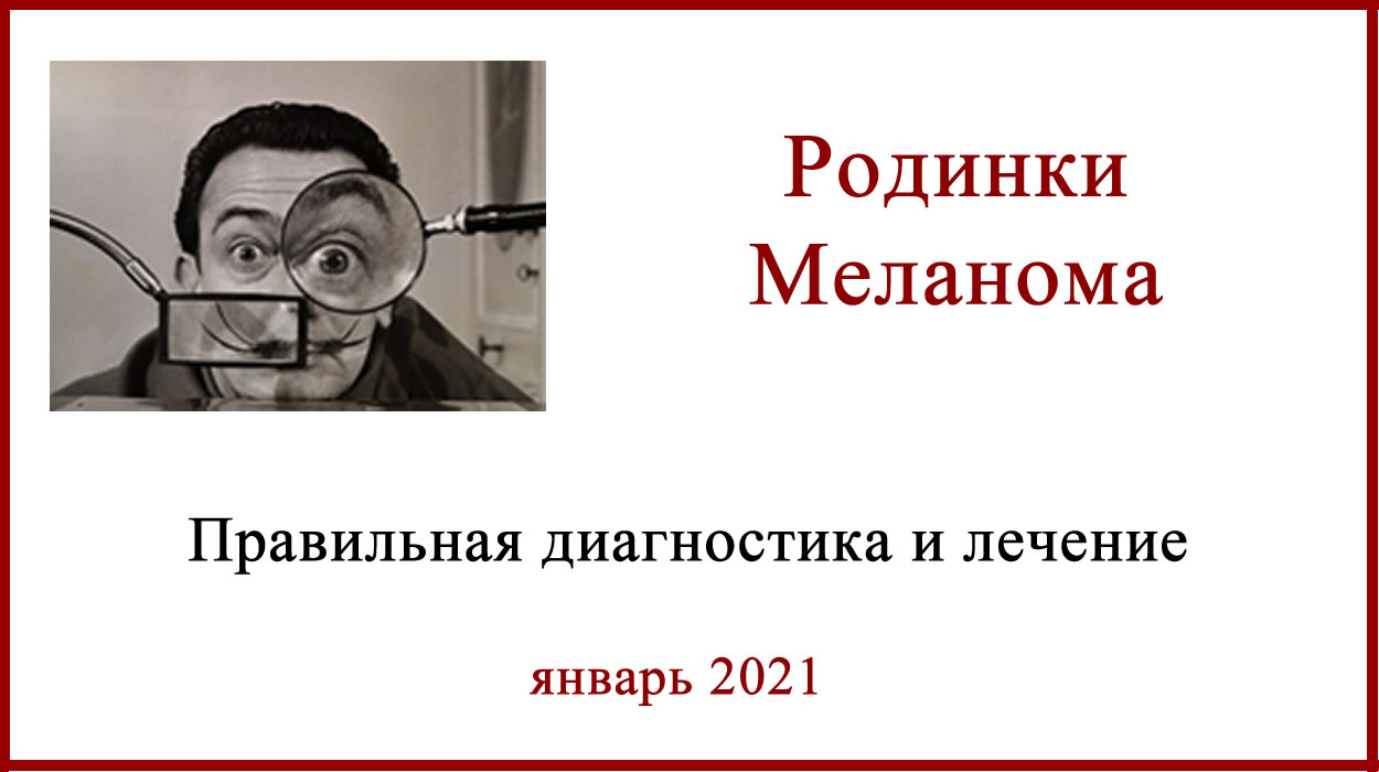 родинки-меланома
