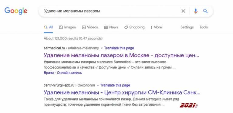 Удаление меланомы лазером