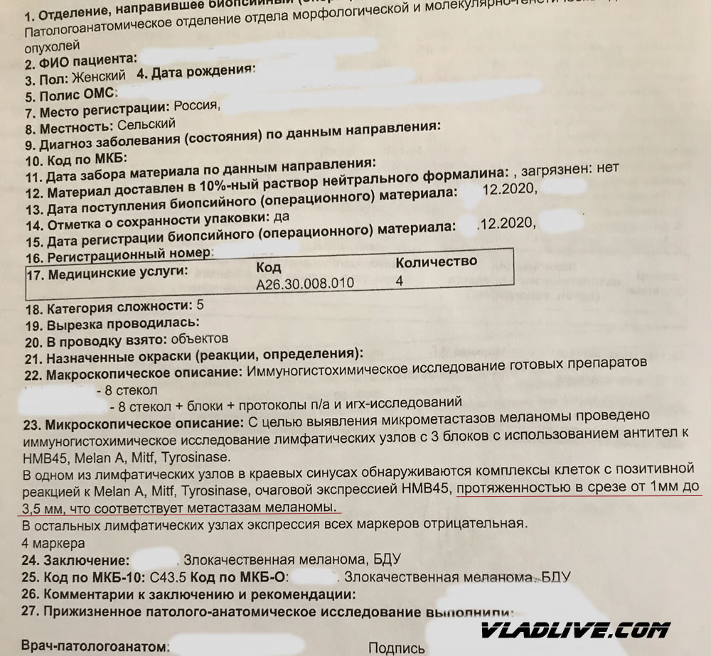 Метастаз меланомы в лимфоузле