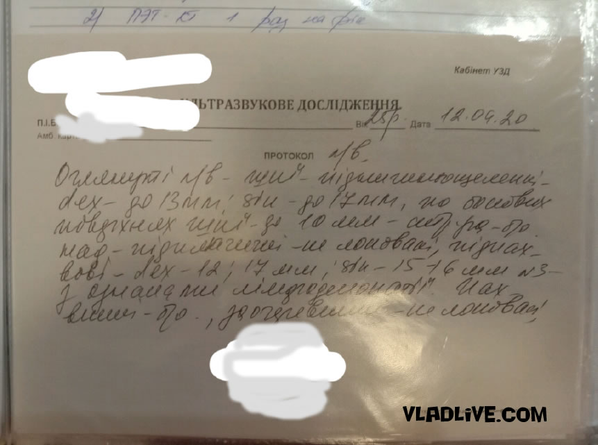 УЗИ лимфоузлов. Меланома Украина