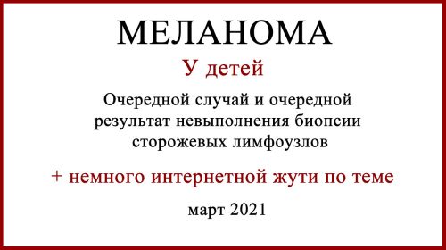 Лечение меланомы у детей. 2021