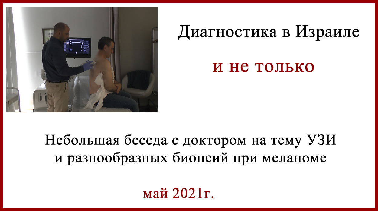 Израиль 2021. Интервью. УЗИ и биопсия при меланоме. Все про биопсию при меланоме.