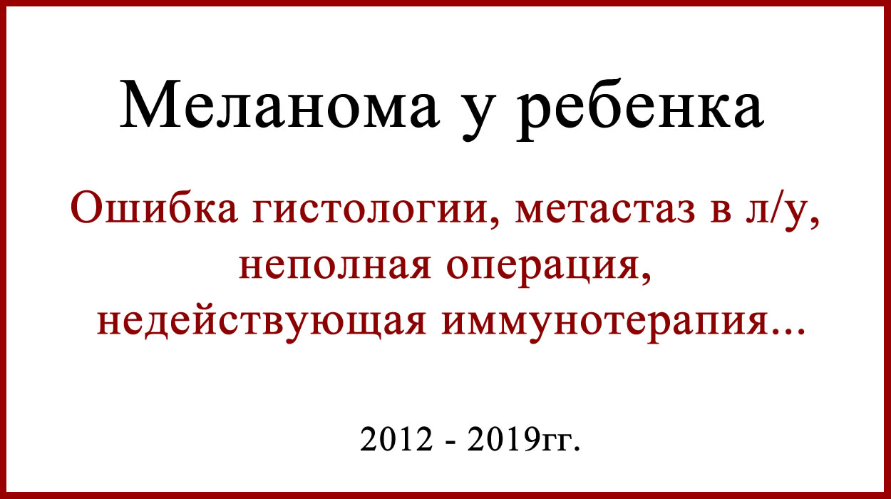 Меланома у ребенка история