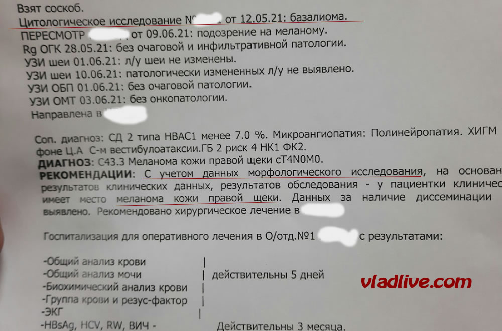 Биопсия при меланоме. Отличие цитологии от гистологии