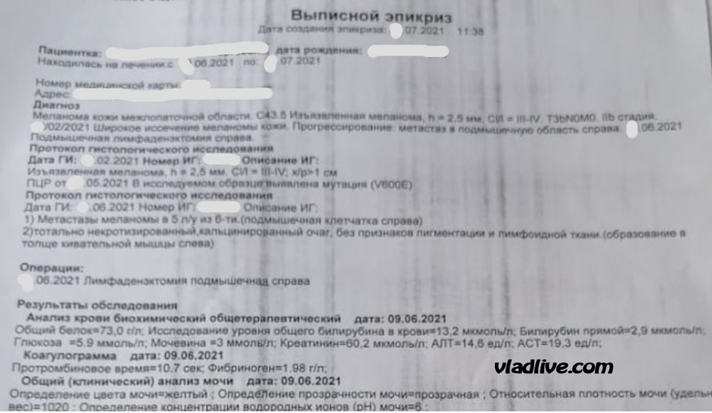 Зачем проводить биопсию сторожевых лимфоузлов
