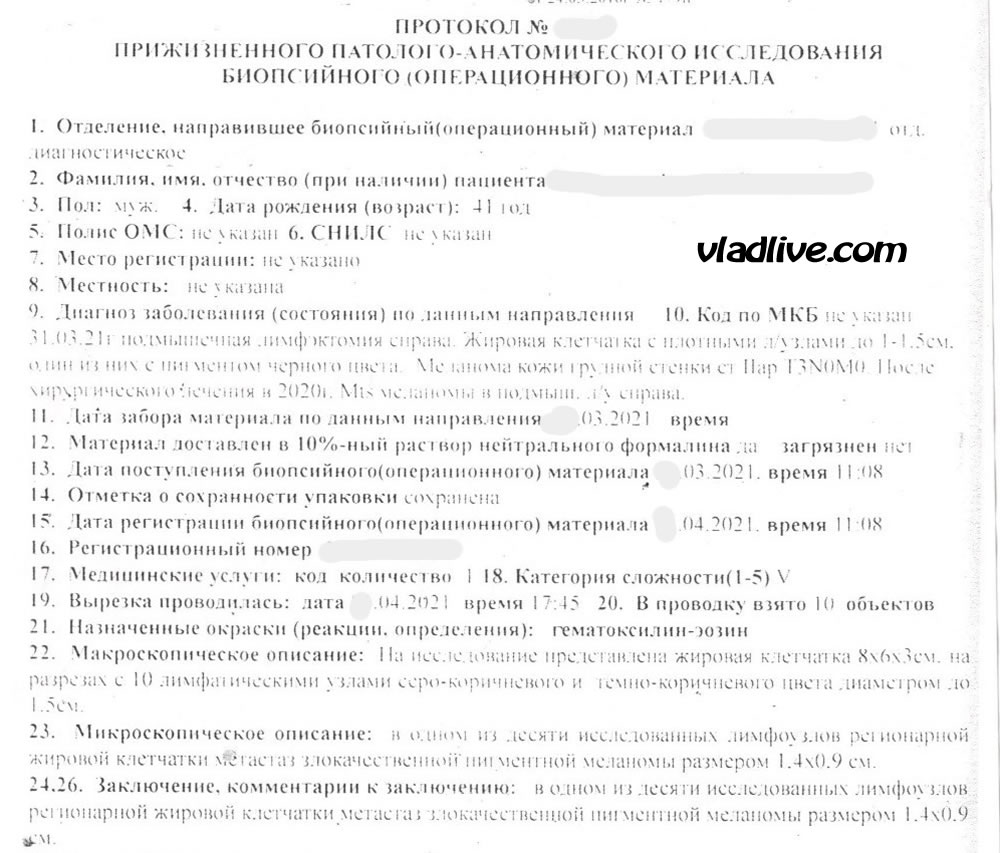 Лечение меланомы в России