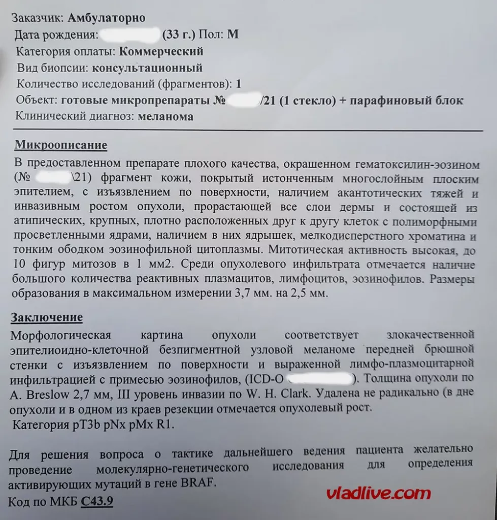 Зачем нужен пересмотр стекол в Израиле? Гистология меланомы в Москве