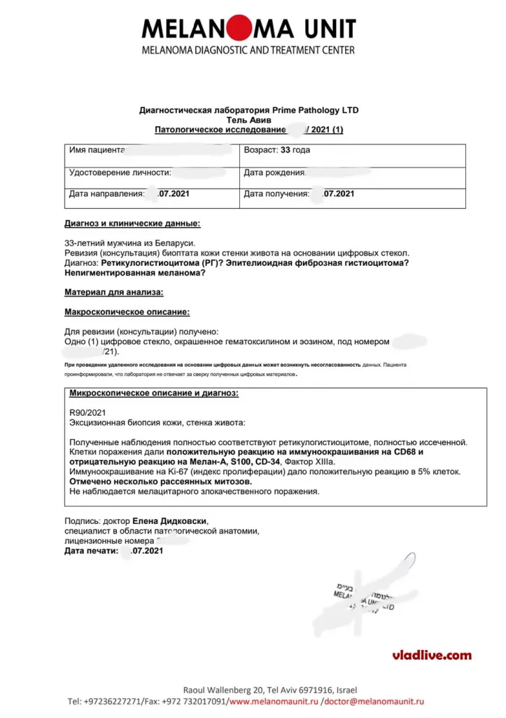 Пересмотр стекол в Израиле