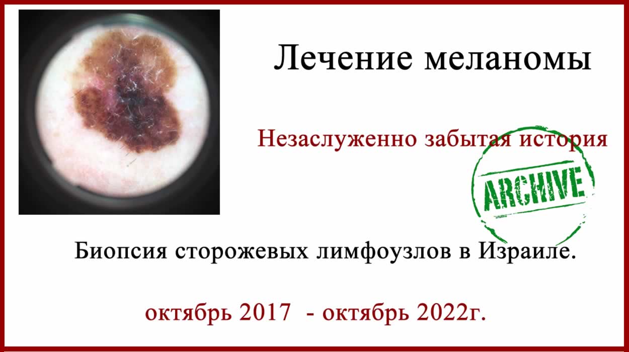 Меланома на спине. Отзыв о лечении в Израиле