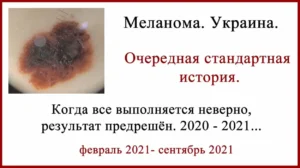 Лечение меланомы в Украине. Стандартно и печально