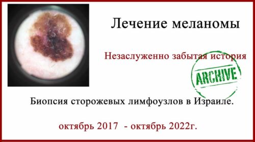Отзыв о лечении в Израиле. Биопсия сторожевых лимфоузлов. 5 лет после операции