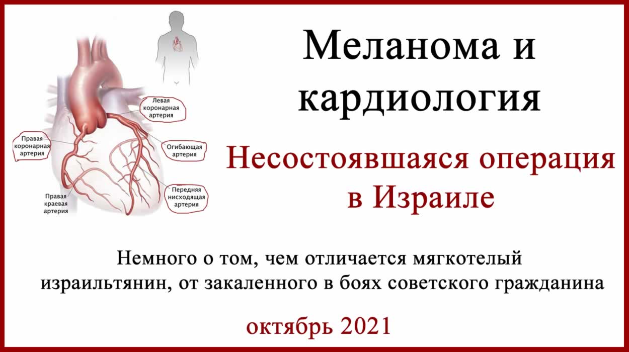 Кардиолог в Израиле и лечение меланомы
