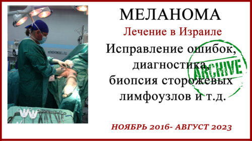 Лечение в Израиле. 7 лет после удаления меланомы и выполнения БСЛУ.
