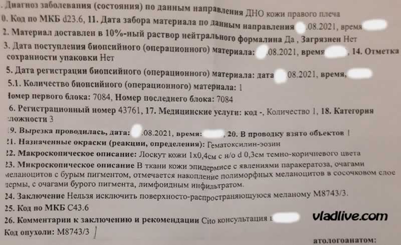 Меланома или невус? Гистология