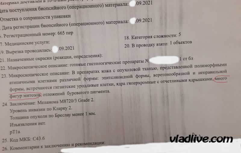 Меланмоа менее 1 мм . Гистология