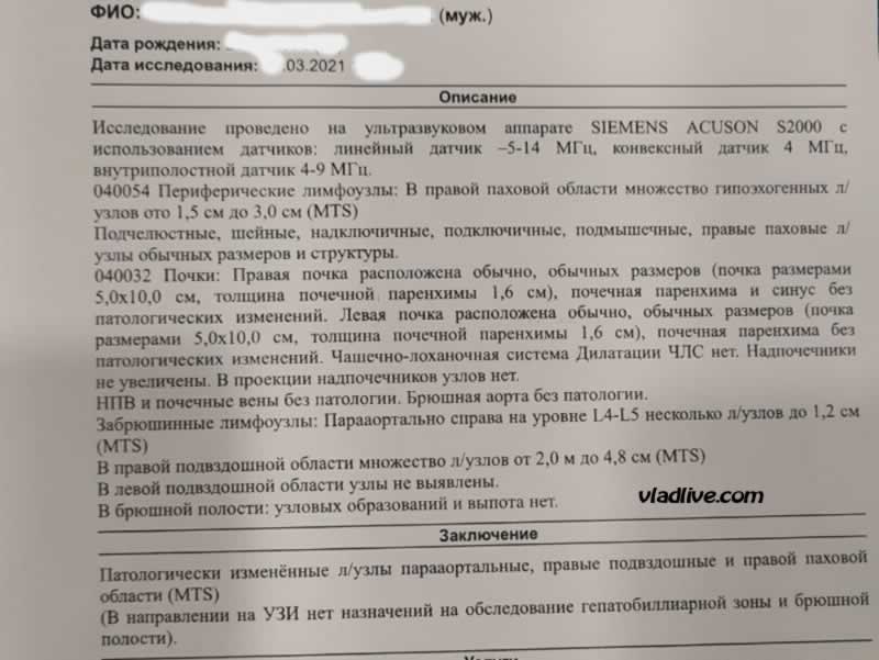 Меланома УЗИ