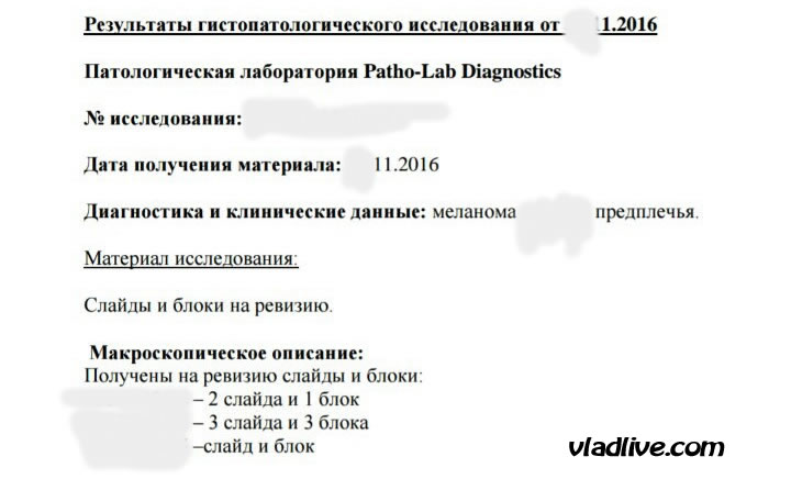 Зачем сдавать родинки на гистологию? Пересмотр гистологии в Израиле