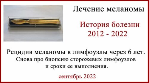 Рецидив меланомы в лимфоузлы через 6 лет после удаления. История лечения