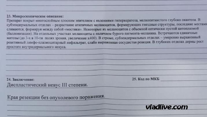 Диспластический невус гистология