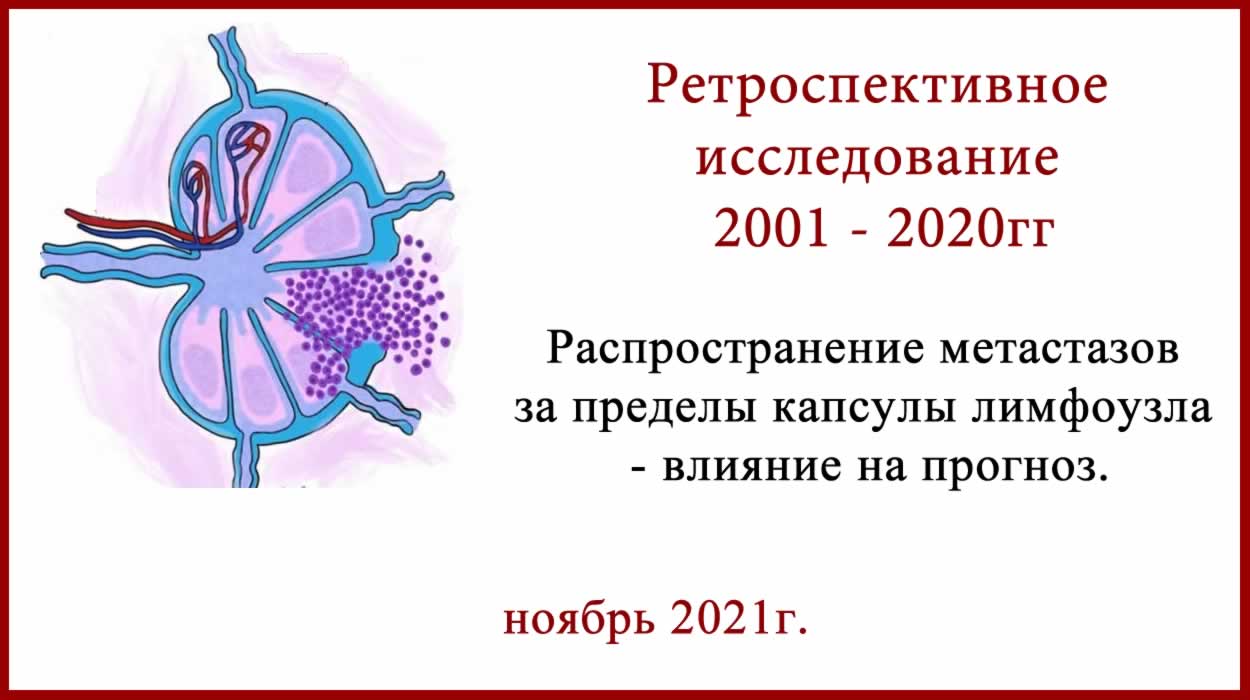 Распространение метастазов за пределы капсулы лимфоузла