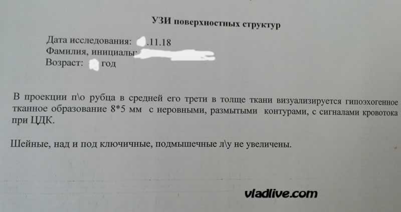 УЗИ рубца после удаления меланомы