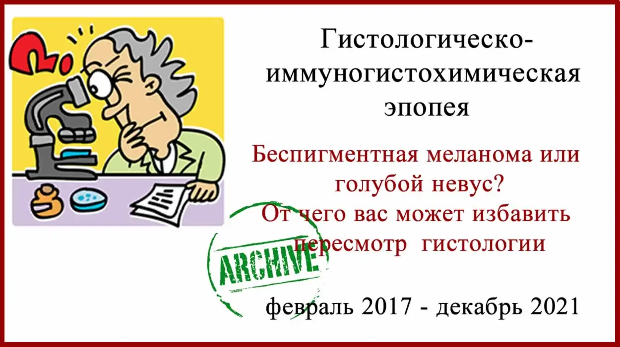 Беспигментная меланома или голубой невус? Гистология и лечение в Израиле
