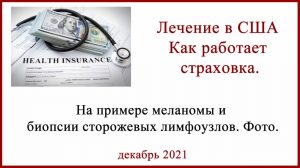 БСЛУ в США. Как работает страховка