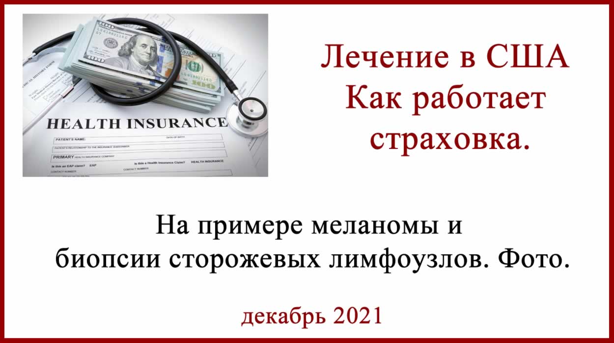 БСЛУ в США. Как работает страховка