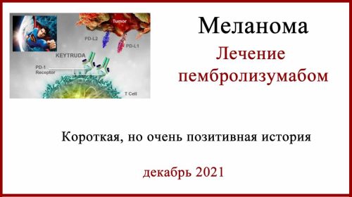 Лечение меланомы Кейтрудой