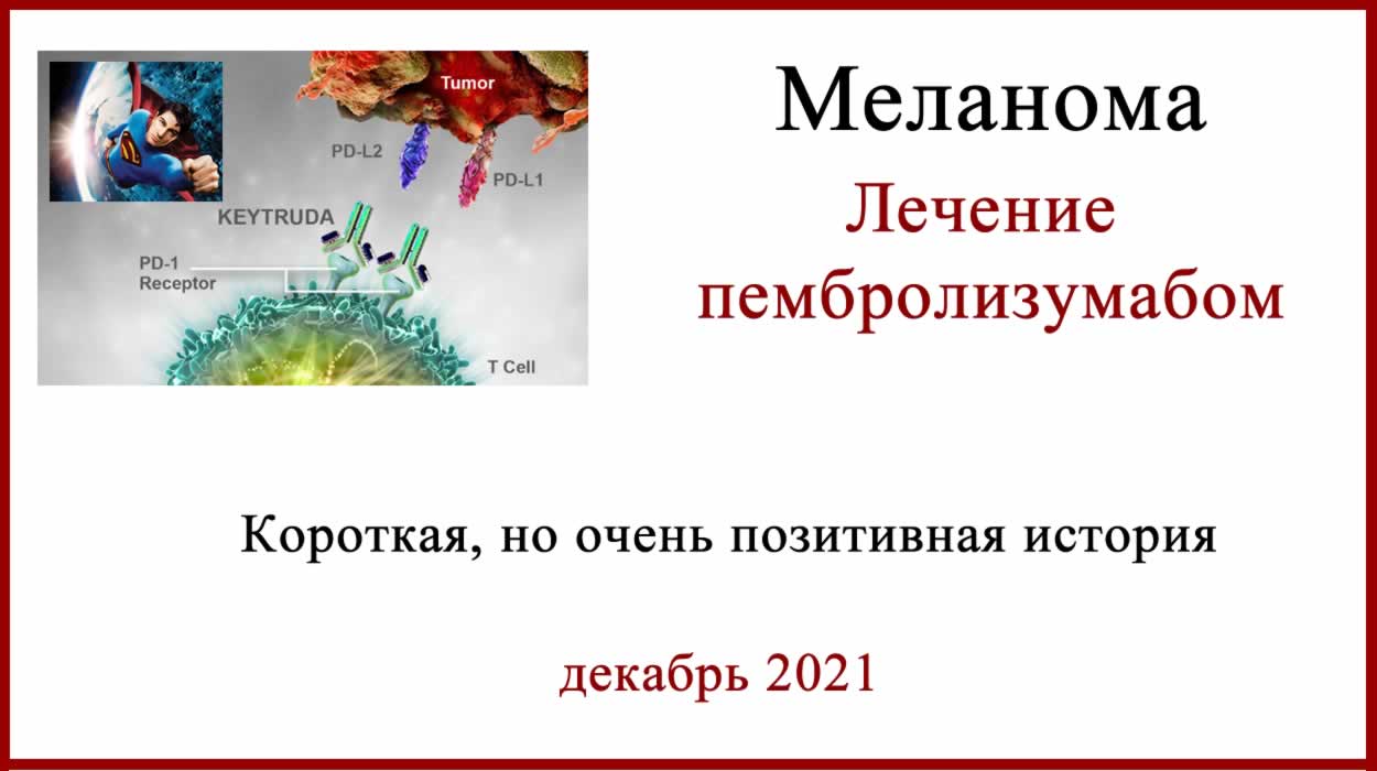 Лечение меланомы Кейтрудой. Немного позитива. Лечение меланомы Кейтрудой