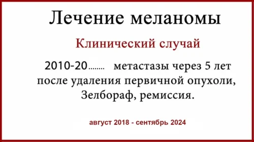 Лечение меланомы клинический случай. Отсутствие БСЛУ и монотерапия Зелборафом