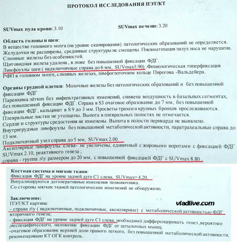 ПЭТ КТ. Меланома и рак щитовидной железы