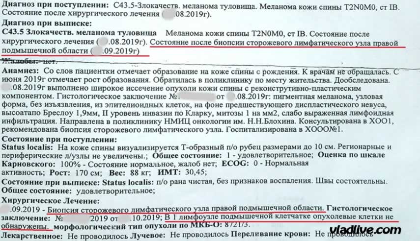 Биопсия сторожевого лимфоузла в Москве