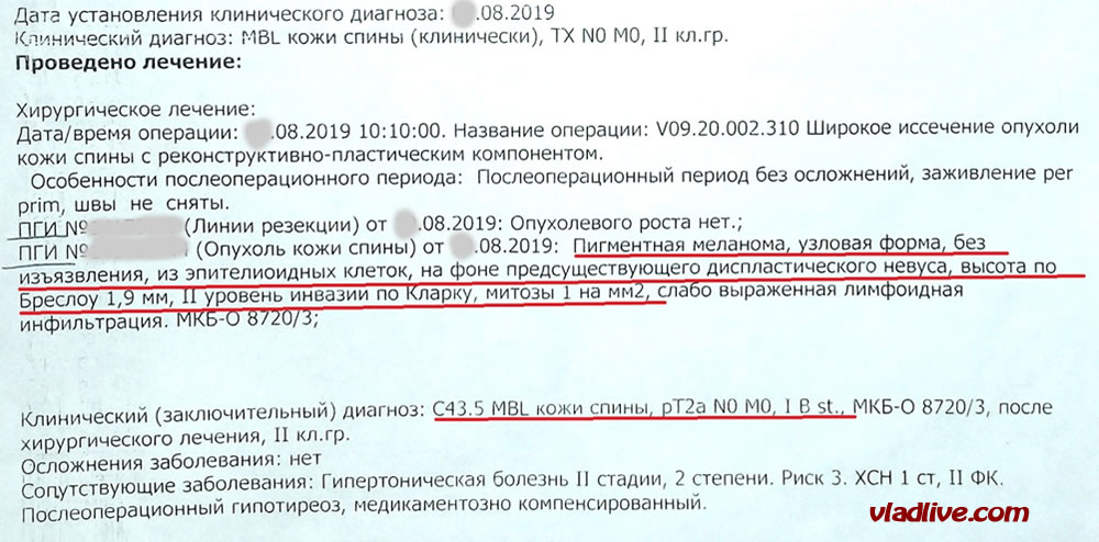 Гистология меланомы фото