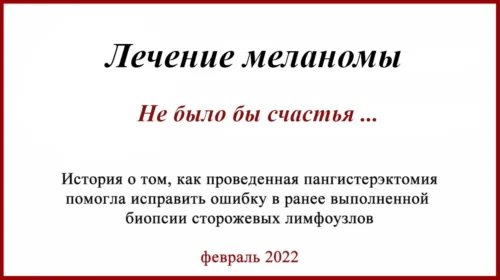 История лечения меланомы. Стандартная ошибка БСЛУ и лимфодиссекция